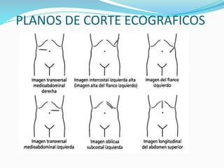 PLANOS DE CORTE ECOGRAFICOS
 