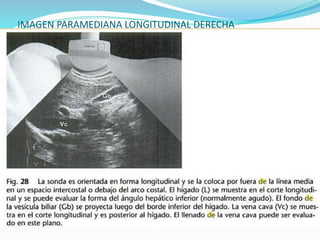 IMAGEN PARAMEDIANA LONGITUDINAL DERECHA
 