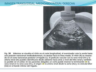IMAGEN TRANSVERSAL, MEDIOABDOMINAL DERECHA
 