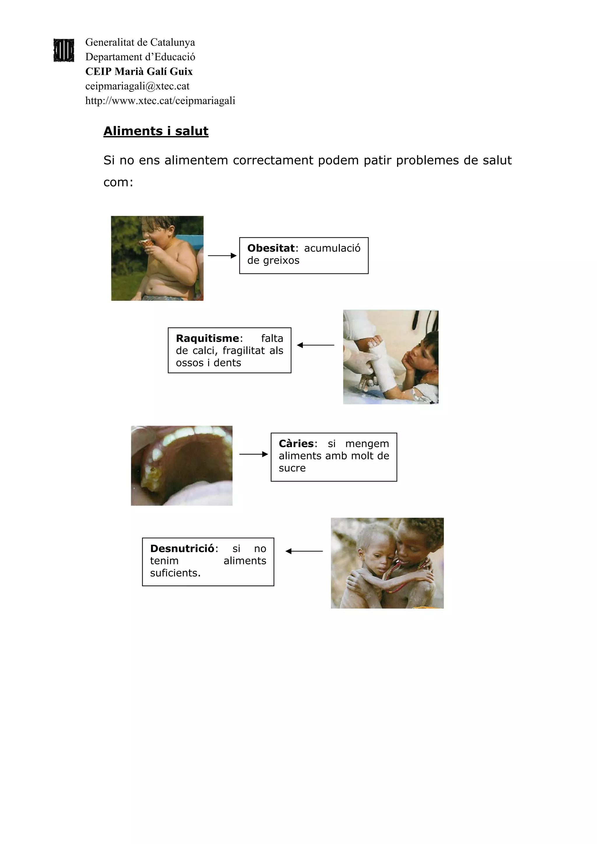 Generalitat de Catalunya
Departament d’Educació
CEIP Marià Galí Guix
ceipmariagali@xtec.cat
http://www.xtec.cat/ceipmariagali

   Aliments i salut

   Si no ens alimentem correctament podem patir problemes de salut
   com:




                                    Obesitat: acumulació
                                    de greixos




                   Raquitisme:        falta
                   de calci, fragilitat als
                   ossos i dents




                                         Càries: si mengem
                                         aliments amb molt de
                                         sucre




              Desnutrició: si no
              tenim       aliments
              suficients.
 