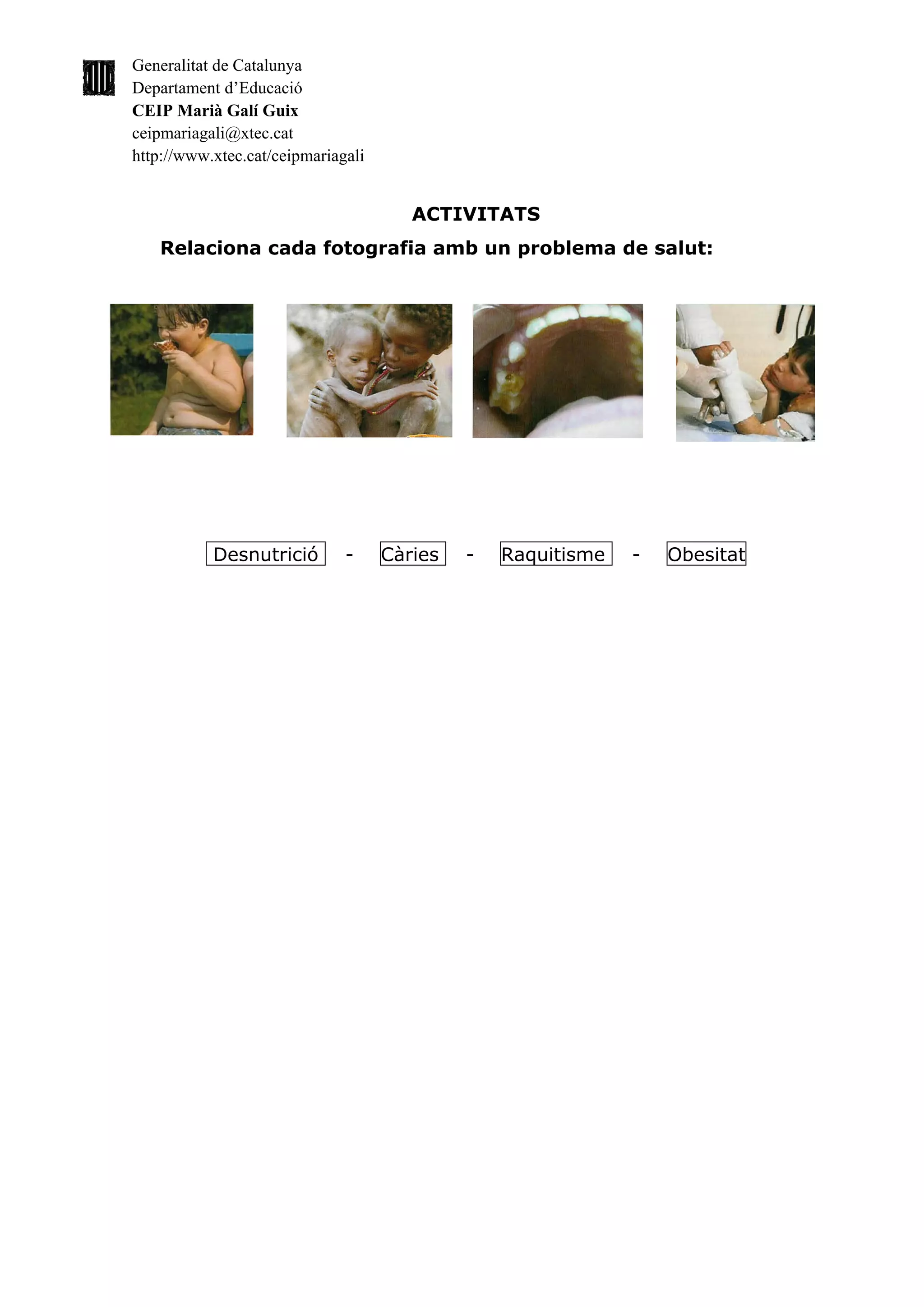Generalitat de Catalunya
Departament d’Educació
CEIP Marià Galí Guix
ceipmariagali@xtec.cat
http://www.xtec.cat/ceipmariagali


                                       ACTIVITATS
   Relaciona cada fotografia amb un problema de salut:




           Desnutrició        -     Càries   -   Raquitisme   -   Obesitat
 