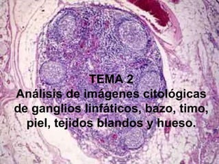 TEMA 2
Análisis de imágenes citológicas
de ganglios linfáticos, bazo, timo,
piel, tejidos blandos y hueso.
 