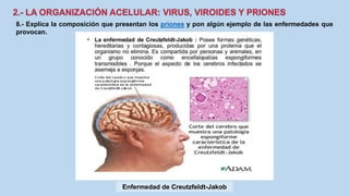 8.- Explica la composición que presentan los priones y pon algún ejemplo de las enfermedades que
provocan.
Enfermedad de Creutzfeldt-Jakob
 
