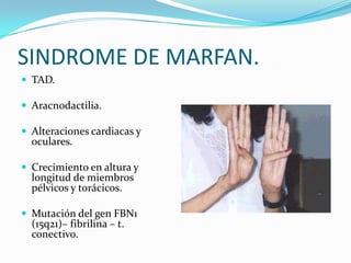 SINDROME DE MARFAN.
 TAD.

 Aracnodactilia.

 Alteraciones cardiacas y
  oculares.

 Crecimiento en altura y
  longitud de miembros
  pélvicos y torácicos.

 Mutación del gen FBN1
  (15q21)– fibrilina – t.
  conectivo.
 