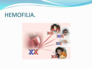 HEMOFILIA.
 