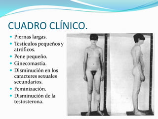 CUADRO CLÍNICO.
 Piernas largas.
 Testículos pequeños y
    atróficos.
   Pene pequeño.
   Ginecomastia.
   Disminución en los
    caracteres sexuales
    secundarios.
   Feminización.
   Disminución de la
    testosterona.
 