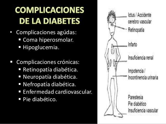 Diabetes mellitus tipo 2 Diabetes mellitus tipo 2