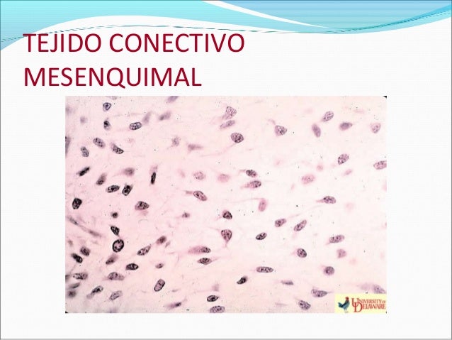 Resultado de imagen para tejido conjuntivo mesenquimal