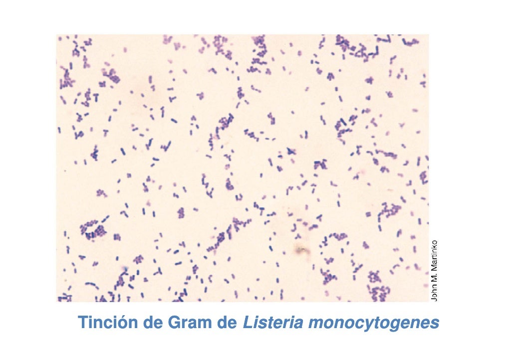 Tema2026.bacillus listeria lactobacillus