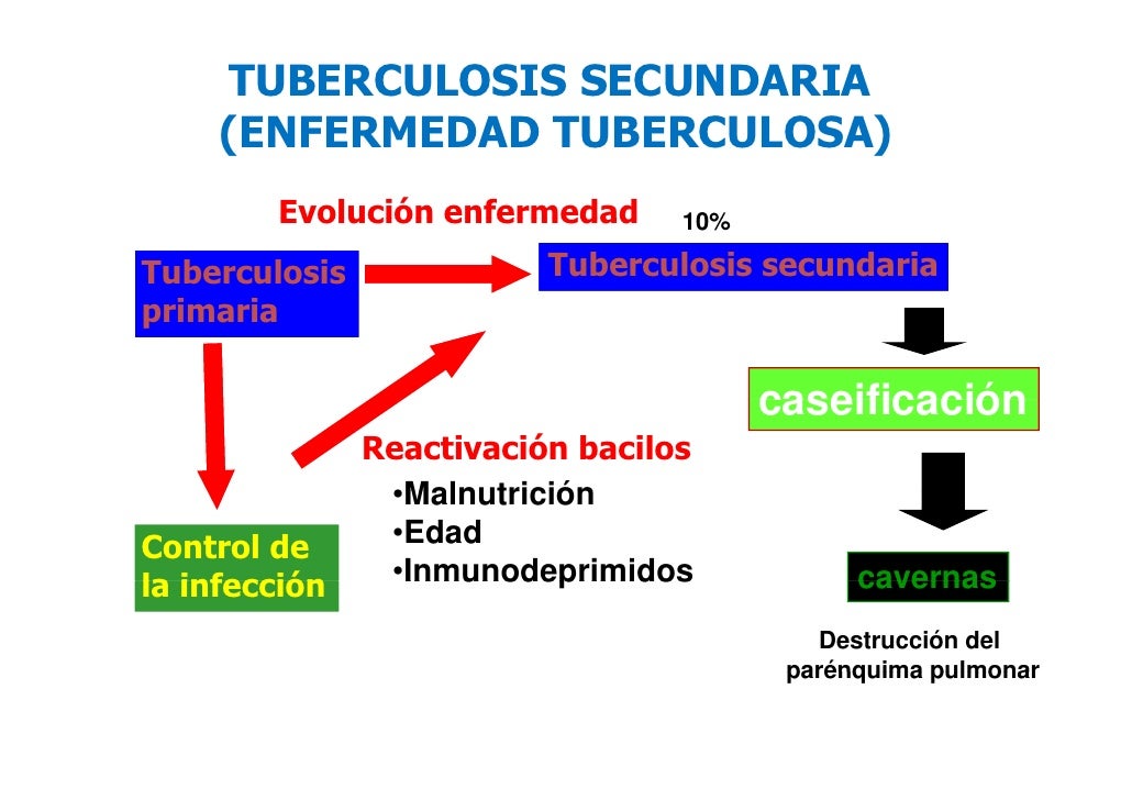 La osteocondrosis del disco intervertebral de 1 grado