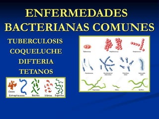 ENFERMEDADES
BACTERIANAS COMUNES
TUBERCULOSIS
COQUELUCHE
DIFTERIA
TETANOS
 