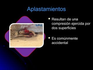 Aplastamientos
 Resultan de una
compresión ejercida por
dos superficies
 Es comúnmente
accidental
 