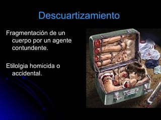 Descuartizamiento
Fragmentación de un
cuerpo por un agente
contundente.
Etilolgia homicida o
accidental.
 