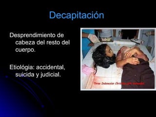 Decapitación
Desprendimiento de
cabeza del resto del
cuerpo.
Etiológia: accidental,
suicida y judicial.
 