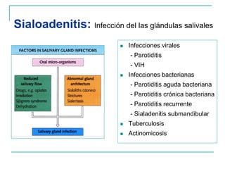 Sialoadenitis: Infección del las glándulas salivales
 Infecciones virales
- Parotiditis
- VIH
 Infecciones bacterianas
- Parotiditis aguda bacteriana
- Parotiditis crónica bacteriana
- Parotiditis recurrente
- Sialadenitis submandibular
 Tuberculosis
 Actinomicosis
 