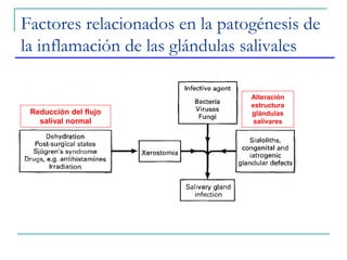 Factores relacionados en la patogénesis de
la inflamación de las glándulas salivales
Reducción del flujo
salival normal
Alteración
estructura
glándulas
salivares
 