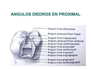 ANGULOS DIEDROS EN PROXIMAL
 