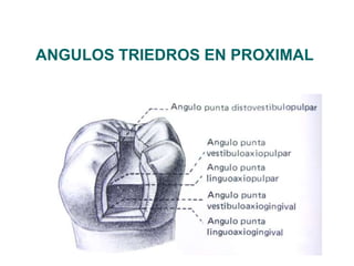 ANGULOS TRIEDROS EN PROXIMAL
 