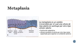 La metaplasia es un cambio
irreversible por el cual una célula de
tipo adulto se sustituye por otro tipo
celular adulto
• Sustitución adaptativa
• células sensibles al estrés por otro tipo mejor
capacitado para soportar un ambiente adverso

 