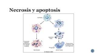 Tema 2 lesión y muerte celular