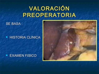 VALORACIÓN
PREOPERATORIA
SE BASA :



HISTORIA CLINICA



EXAMEN FISICO

 