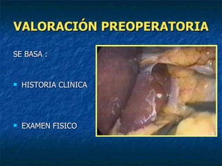 VALORACIÓN PREOPERATORIA SE BASA : HISTORIA CLINICA EXAMEN FISICO 