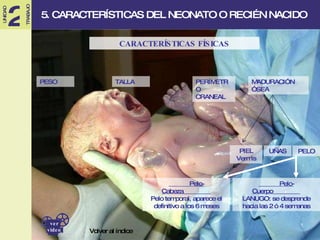 PIEL Vermis UÑAS PELO ______Pelo-Cabeza________ Pelo temporal, aparece el definitivo a los 6 meses ______Pelo-Cuerpo________ LANUGO: se desprende hacia las 2 ó 4 semanas 5. CARACTERÍSTICAS DEL NEONATO O RECIÉN NACIDO Volver al índice PESO TALLA PERÍMETRO CRANEAL MADURACIÓN ÓSEA CARACTERÍSTICAS FÍSICAS ver video 