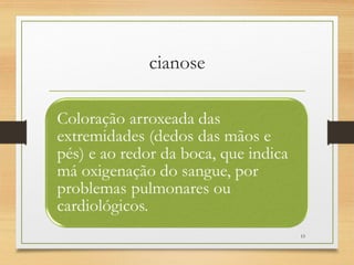 cianose
15
 
