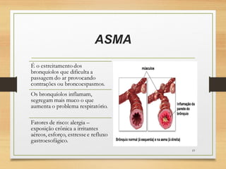 ASMA
19
 