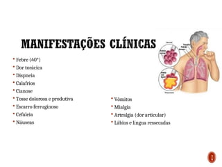  Febre (40°)
 Dor torácica
 Dispneia
 Calafrios
 Cianose
 Tosse dolorosa e produtiva
 Escarro ferruginoso
 Cefaleia
 Náuseas
 Vômitos
 Mialgia
 Artralgia (dor articular)
 Lábios e língua ressecadas
29
2
9
 