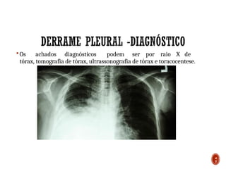  Os achados diagnósticos podem ser por raio X de
tórax, tomografia de tórax, ultrassonografia de tórax e toracocentese.
4
0
 