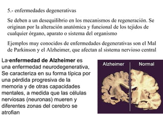 5.- enfermedades degenerativas Se deben a un desequilibrio en los mecanismos de regeneración. Se originan por la alteración anatómica y funcional de los tejidos de cualquier órgano, aparato o sistema del organismo Ejemplos muy conocidos de enfermedades degenerativas son el Mal de Parkinson y el Alzheimer, que afectan al sistema nervioso central - La  enfermedad de Alzheimer  es una enfermedad neurodegenerativa, Se caracteriza en su forma típica por una pérdida progresiva de la memoria y de otras capacidades mentales, a medida que las células nerviosas (neuronas) mueren y diferentes zonas del cerebro se atrofian 