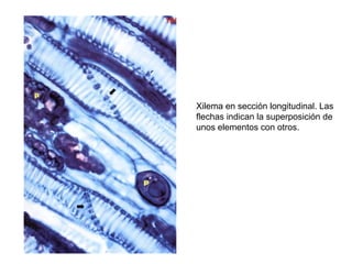 Xilema en sección longitudinal. Las
flechas indican la superposición de
unos elementos con otros.
 