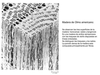 Madera de Olmo americano:

Se observan las tres superficies de la
madera: transversal, radial y tangencial.
Es una madera de anillos semiporosos
con las traqueas de otoño dispuestas en
líneas onduladas.
Se distinguen las traqueas y los radios.
La porción densa de la madera esta
compuesta principalmente por fibras.
 