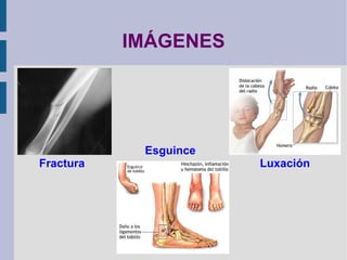 huesos se unen forman las articulaciones. 