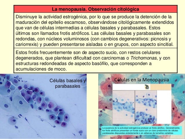 Tema 3. Citología Ginecológica