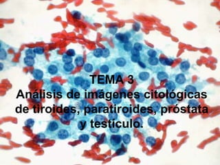 TEMA 3
Análisis de imágenes citológicas
de tiroides, paratiroides, próstata
y testículo.
 