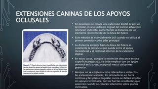 EXTENSIONES CANINAS DE LOS APOYOS
OCLUSALES • En ocasiones se coloca una extensión disital desde un
premolar en una vertiente lingual del canino adyacente
retención indirecta, aumentando la distancia de un
elemento resistente desde la línea del fulcro
• Este método es especialmente útil cuando se utiliza el
primer premolar como pilar principal
• La distancia anterior hasta la línea del fulcro es
solamente la distancia que queda entre el apoyo
mesioclusal y el terminal anterior de la extensión
digital.
• En estos casos, aunque la extensión descanse en una
superficie preparada, se debe emplear con un apoyo
terminal en la cresta marginal mesial del primer
premolar.
• Aunque no se empleen como retenedores indirectos,
las extensiones caninas, los retenedores en barra
continua y las placas linguales nunca se deben emplear
sin apoyos terminales, por las fuerzas resultantes que
aparecen cuando se colocan solamente sobre planos
inclinados.
 