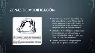 ZONAS DE MODIFICACIÓN
• En ocasiones, el apoyo oclusal de un
pilar secundario en una PPR de clase II
puede servir como retenedor indirecto,
dependiendo de la distancia entre la
línea del fulcro y el pilar secundario.
• En la clase II, modificación I, los pilares
principales son los adyacentes a la
extensión distal de base y el pilar más
distal del lado dentosoportado.
• La línea de fulcro es un eje diagonal
entre los dos pilares terminales.
 