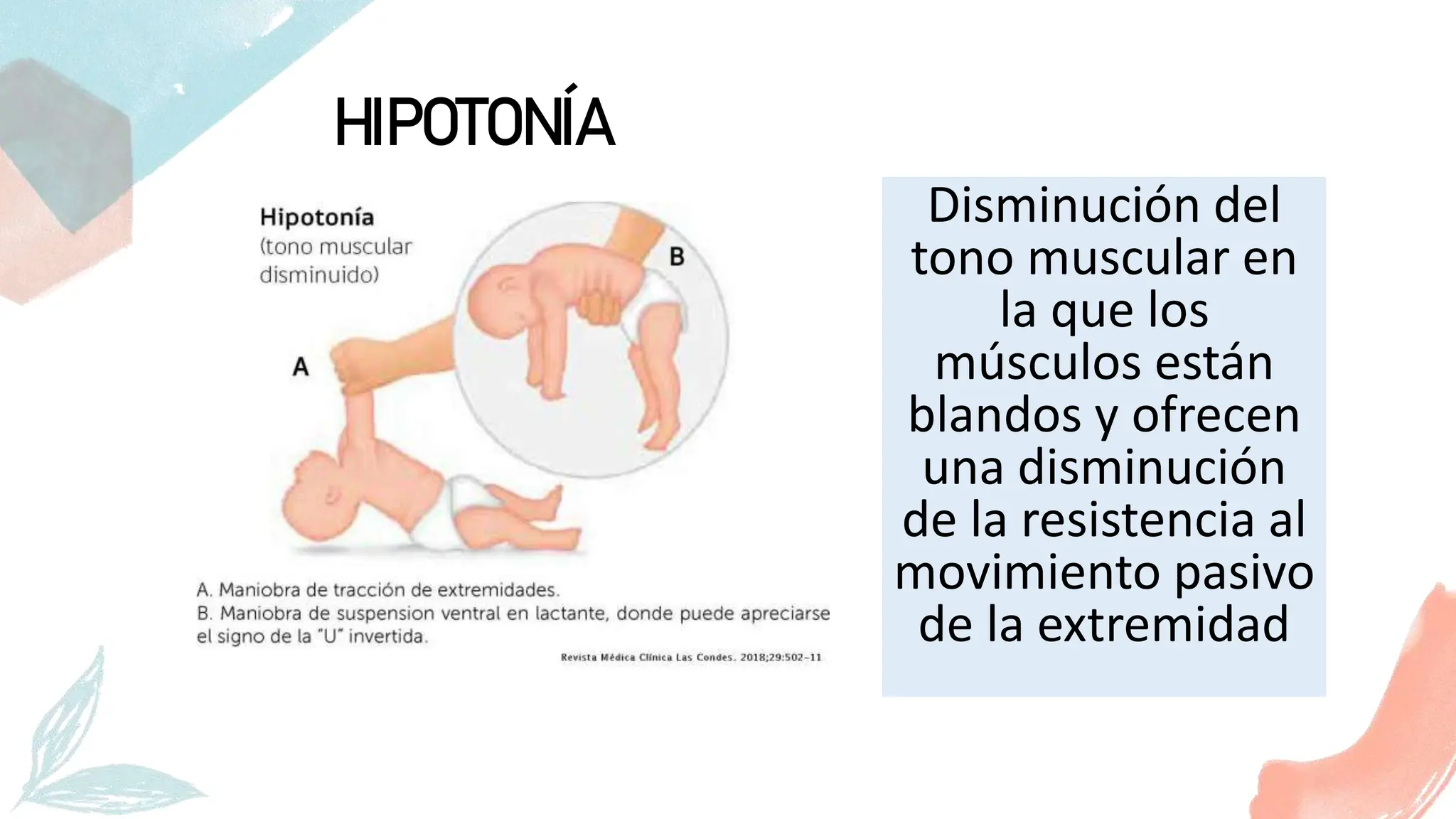 Tema 3.- Tono musuclar, hipotonia, hipertonia, rigidez, flacidez ...