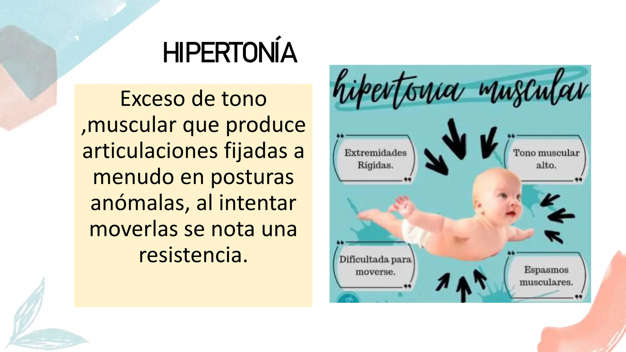 Tema 3.- Tono musuclar, hipotonia, hipertonia, rigidez, flacidez ...