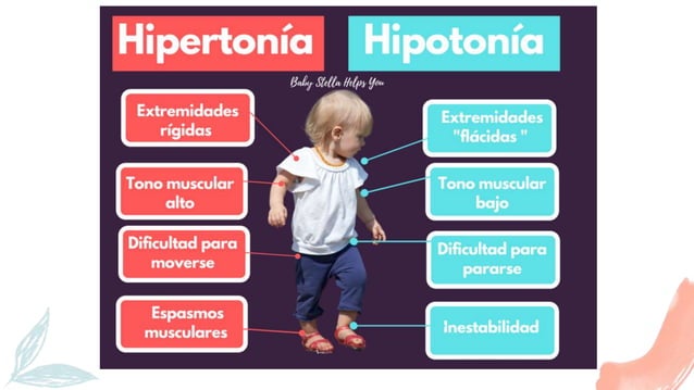 Tema 3.- Tono musuclar, hipotonia, hipertonia, rigidez, flacidez ...