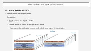 tema-3-procesado-y-tratamiento-de-la-imagen-en-radiolog-a-convencional