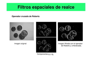 Operador cruzado de Roberts
Filtros espaciales de realce
Imagen original Imagen filtrada con el operador
de Roberts y umbralizada.
Componentes gx y gy.
 