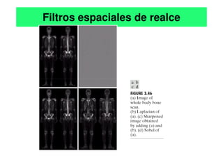 Filtros espaciales de realce
 
