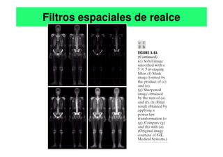 Filtros espaciales de realce
 