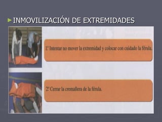 INMOVILIZACIÓN DE EXTREMIDADES 