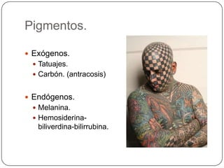 Pigmentos.

 Exógenos.
  Tatuajes.
  Carbón. (antracosis)


 Endógenos.
  Melanina.
  Hemosiderina-
   biliverdina-bilirrubina.
 