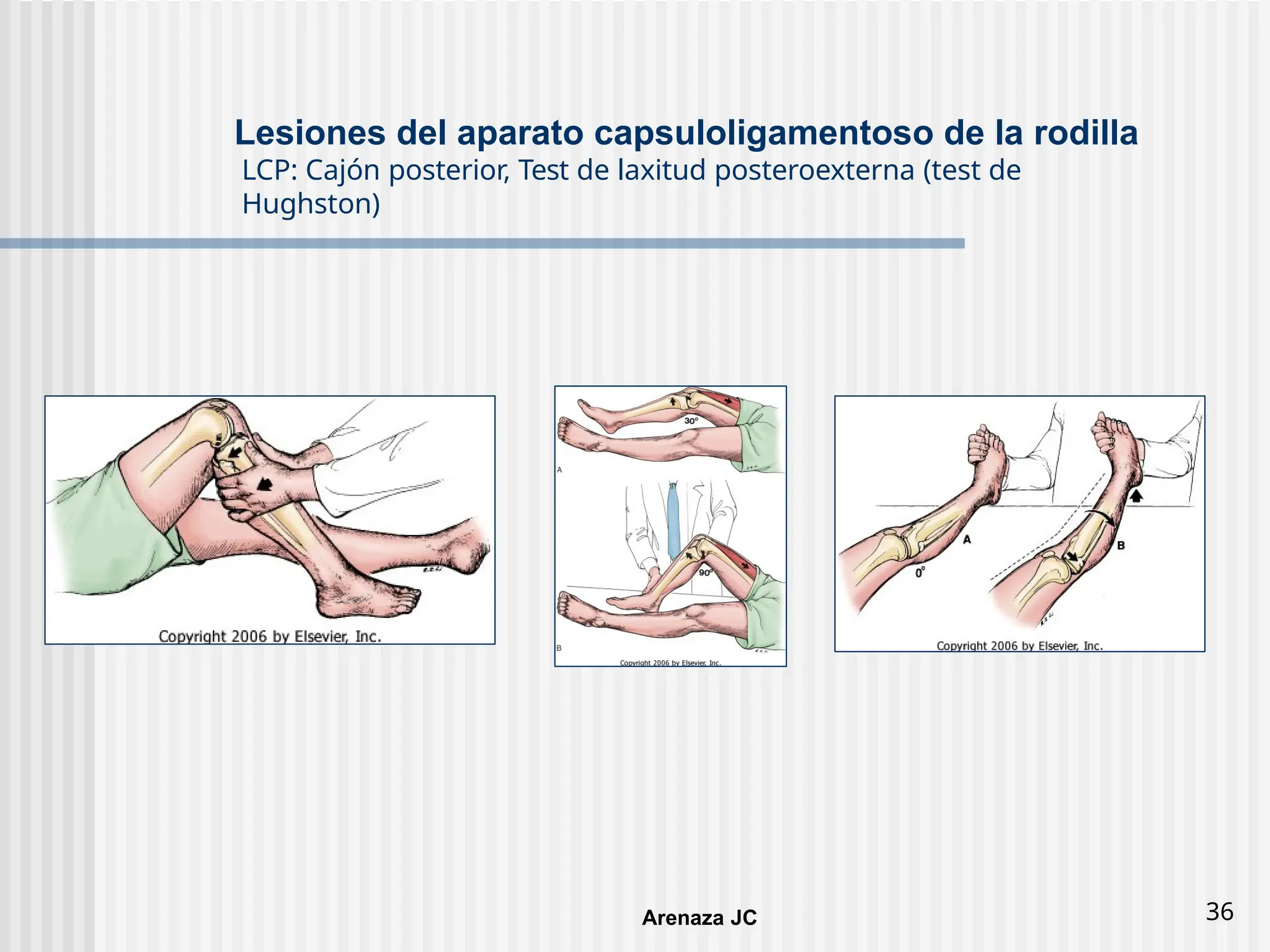 tema-31-rodilla-lesiones-ligamentos-y-meniscos-pptx