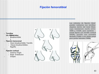 Tibia Rope Tema 31 Rodilla lesiones ligamentos y meniscos.pptx